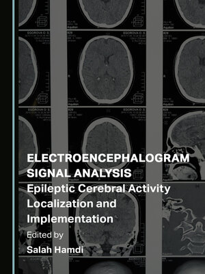 cover image of Electroencephalogram Signal Analysis